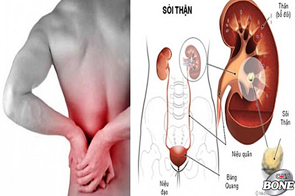 Đau lưng do thoái hóa cột sống và thận yếu khác nhau như thế nào?