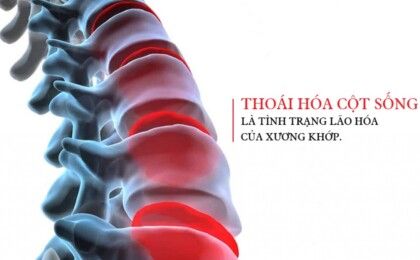 Thuốc điều trị thoái hóa cột sống