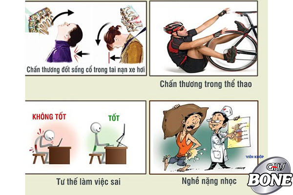 Nguyên nhân nào gây nên thoát vị đĩa đệm cột sống cổ?