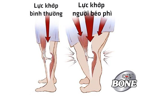 Tăng cân tạo thêm áp lực lên các cơ, khớp