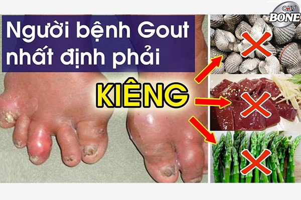 Những món ăn giàu đạm ngày Tết là “nỗi ác mộng” của người bị gout