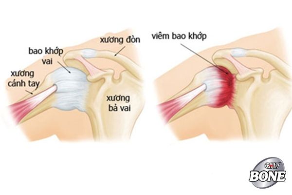 Kết cấu của vai