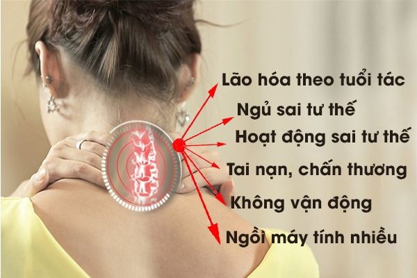 Nhưng nguyên nhân dẫn đến thoái hoa cột sông cổ