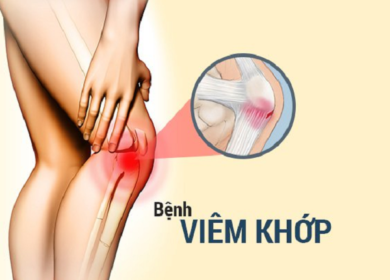 Bệnh viêm khớp