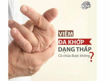 viem-khop-dang-thap-chua-duoc-khong