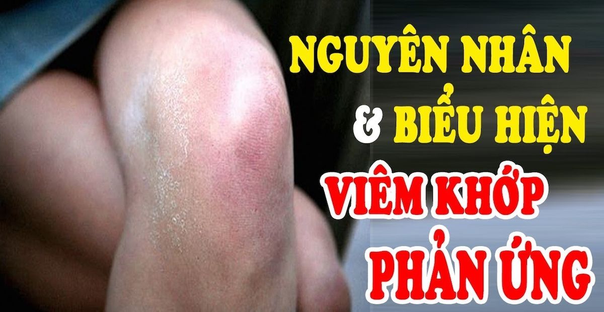 Bệnh viêm khớp phản ứng