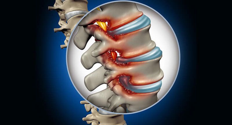 Nhận biết được các biểu hiện, triệu chứng của bệnh sớm để đưa ra hướng điều trị kịp thời