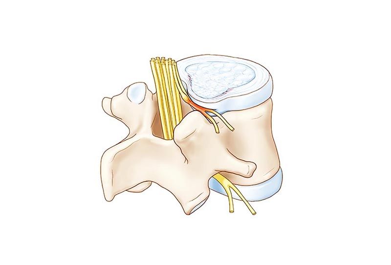 Hình ảnh cấu tạo đĩa đệm bình thường