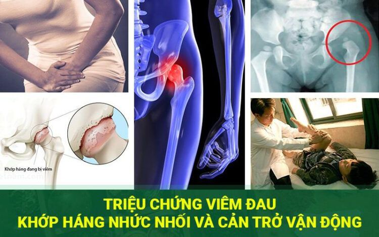 Lão hóa ở tuổi già được coi là nguyên nhân chủ yếu gây ra thoái hóa khớp háng