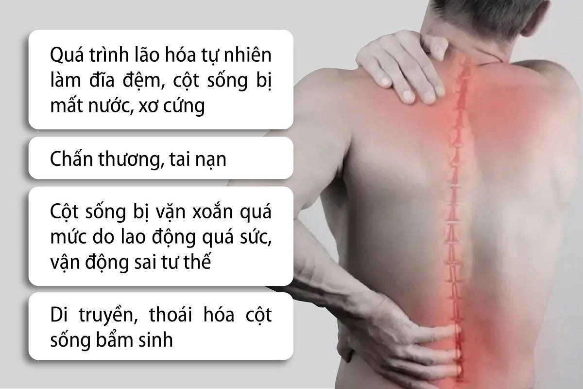 Nguyên nhân gây thoái hoá cột sống