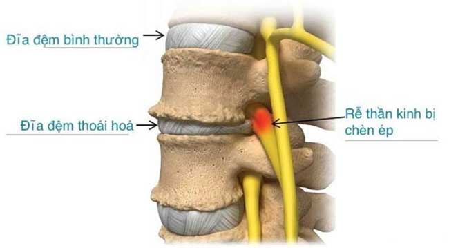 thoai-hoa-dia-dem_1