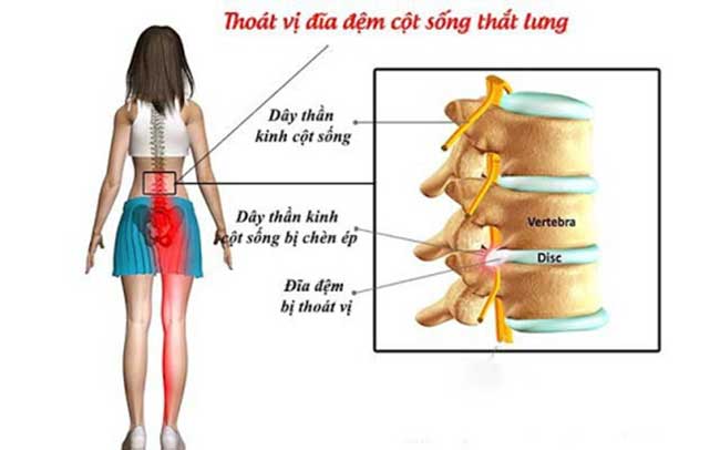 thoai-hoa-dia-dem_14