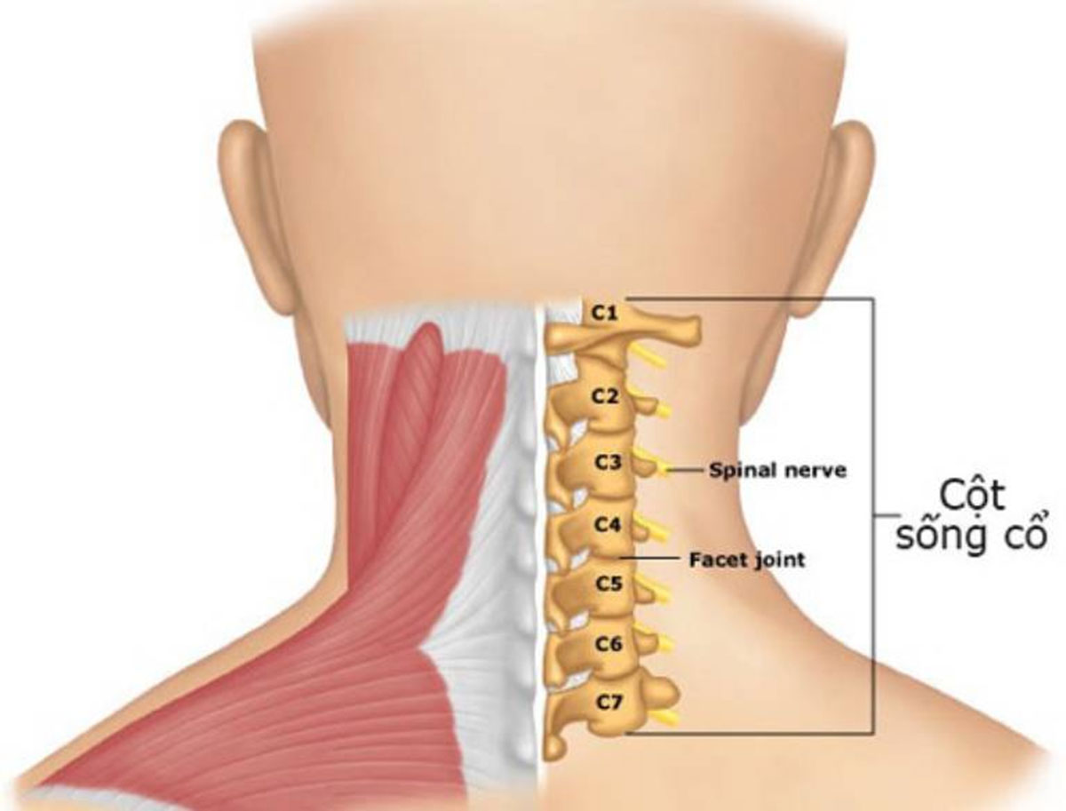 Thoát-vị-đĩa-đệm-cột-sống-cổ-c5-c6_1