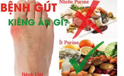 Bệnh gút nên kiêng ăn gì để nhanh khỏi?