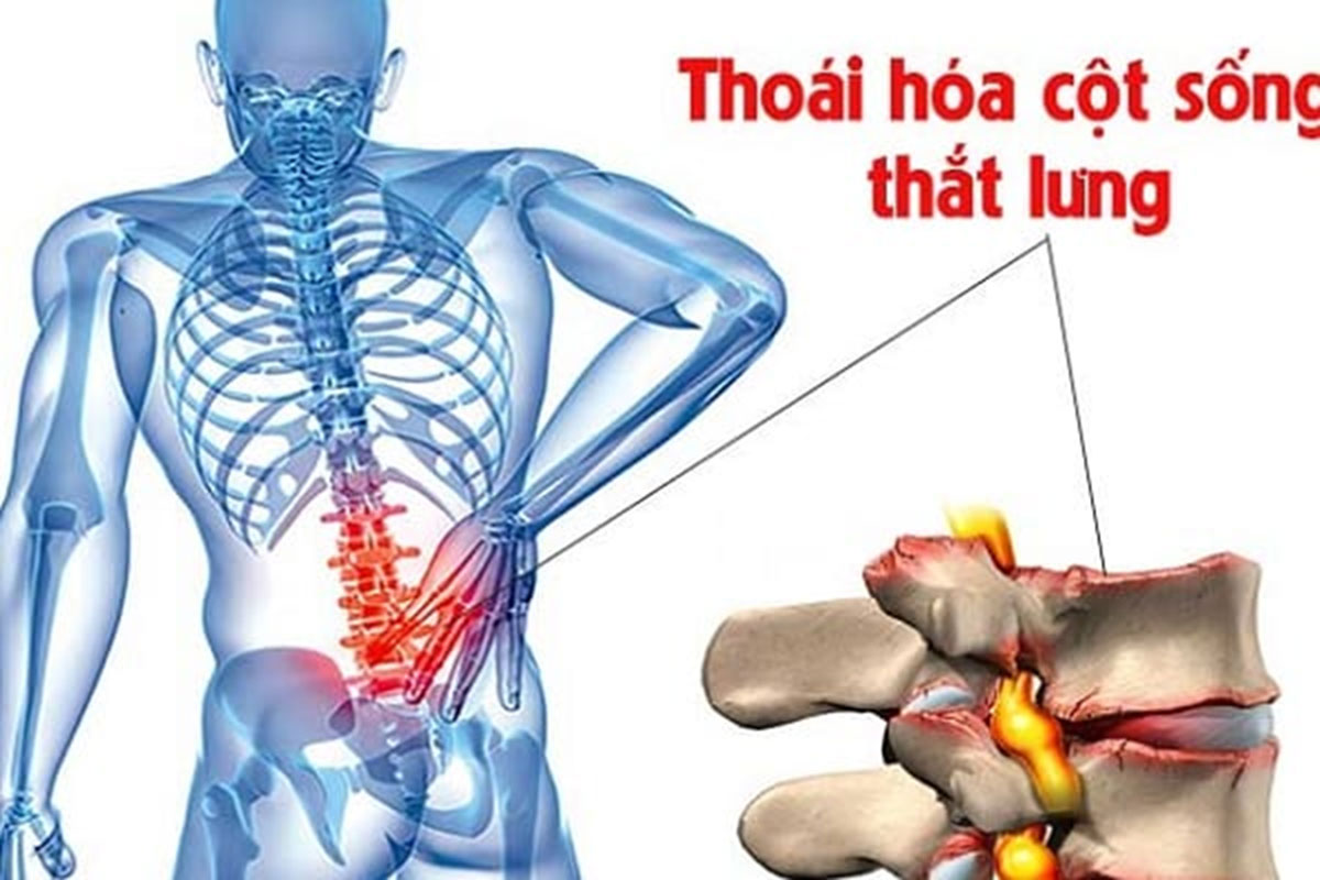 thoai-hoa-cot-song-that-lung_1