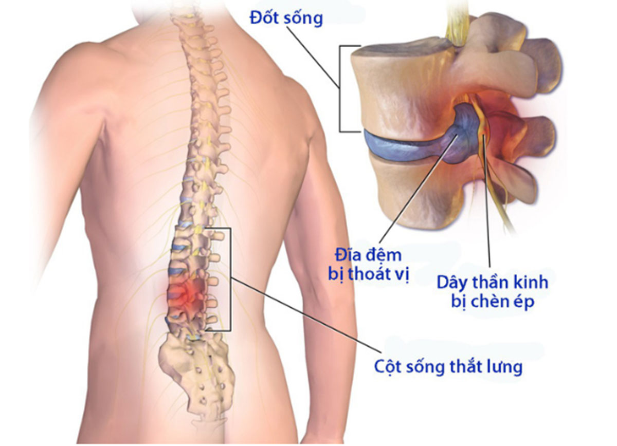 thoai-hoa-cot-song-that-lung_1