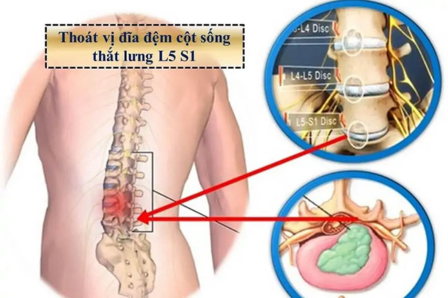 thoai-hoa-dia-dem-cot-song-lung_12