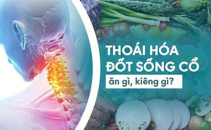 Thoái hóa đốt sống cổ nên ăn gì? Kiêng ăn gì để hỗ trợ trị bệnh