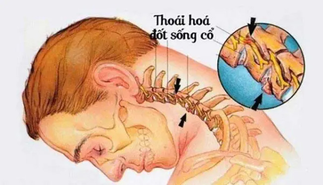 thoai-hoa-dot-song-co_13