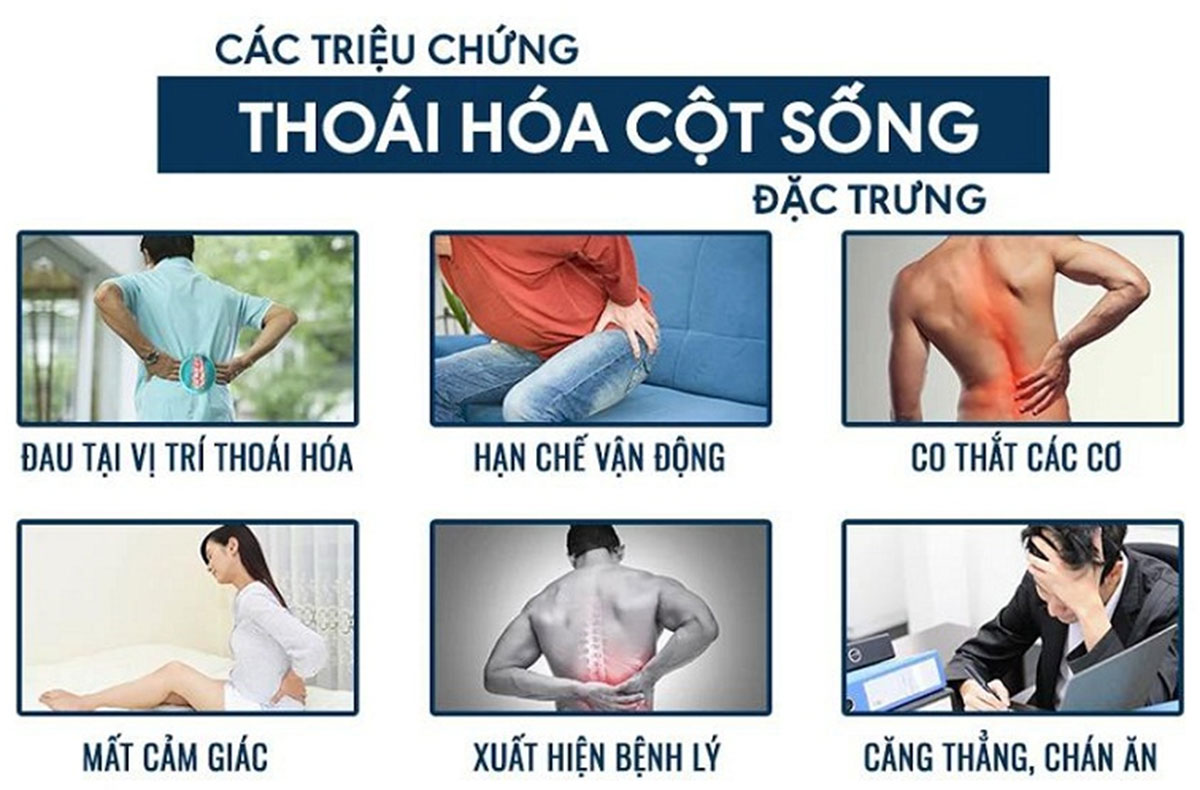 thoai-hoa-cot-song-la-gi-2