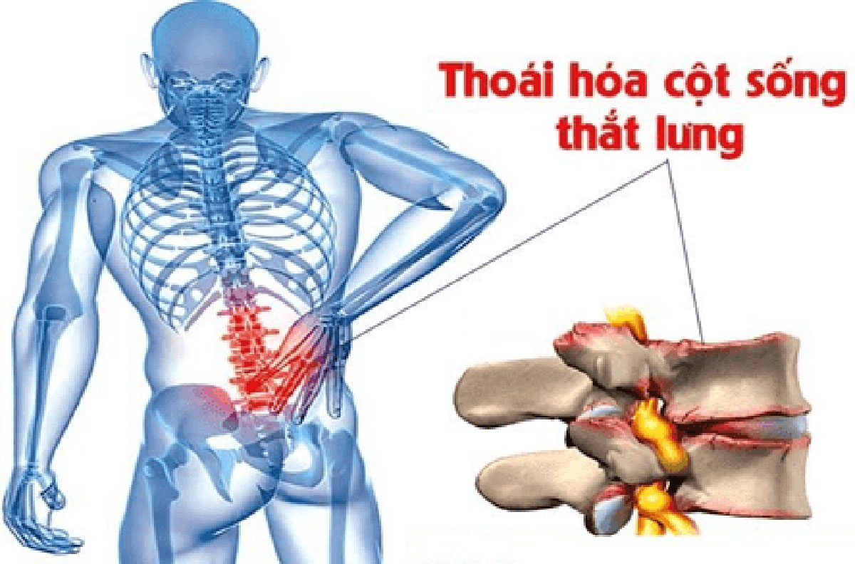 thoai-hoa-cot-song-that-lung_1