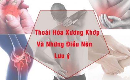 Những điều cần biết về bệnh thoái hóa xương khớp