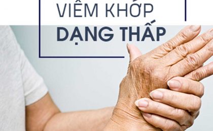 Tổng quan bệnh viêm đa khớp dạng thấp là gì và những lưu ý cần biết